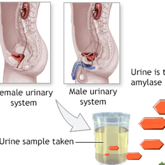 amylase pancreatic alpha urine diastase test